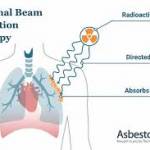 Mesothelioma_treatment Profile Picture