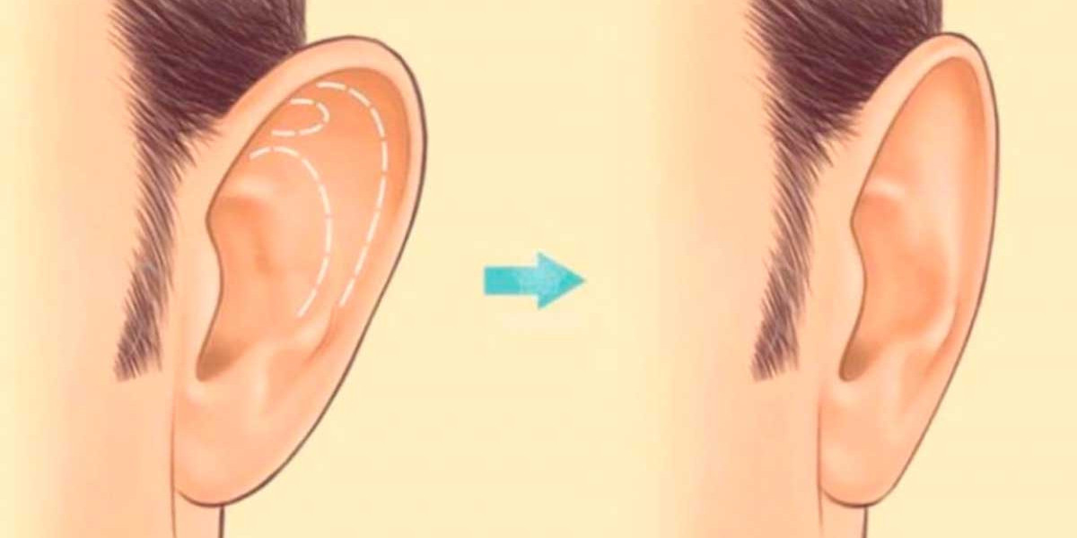 Ear Surgery Consultation: What to Ask Your Surgeon