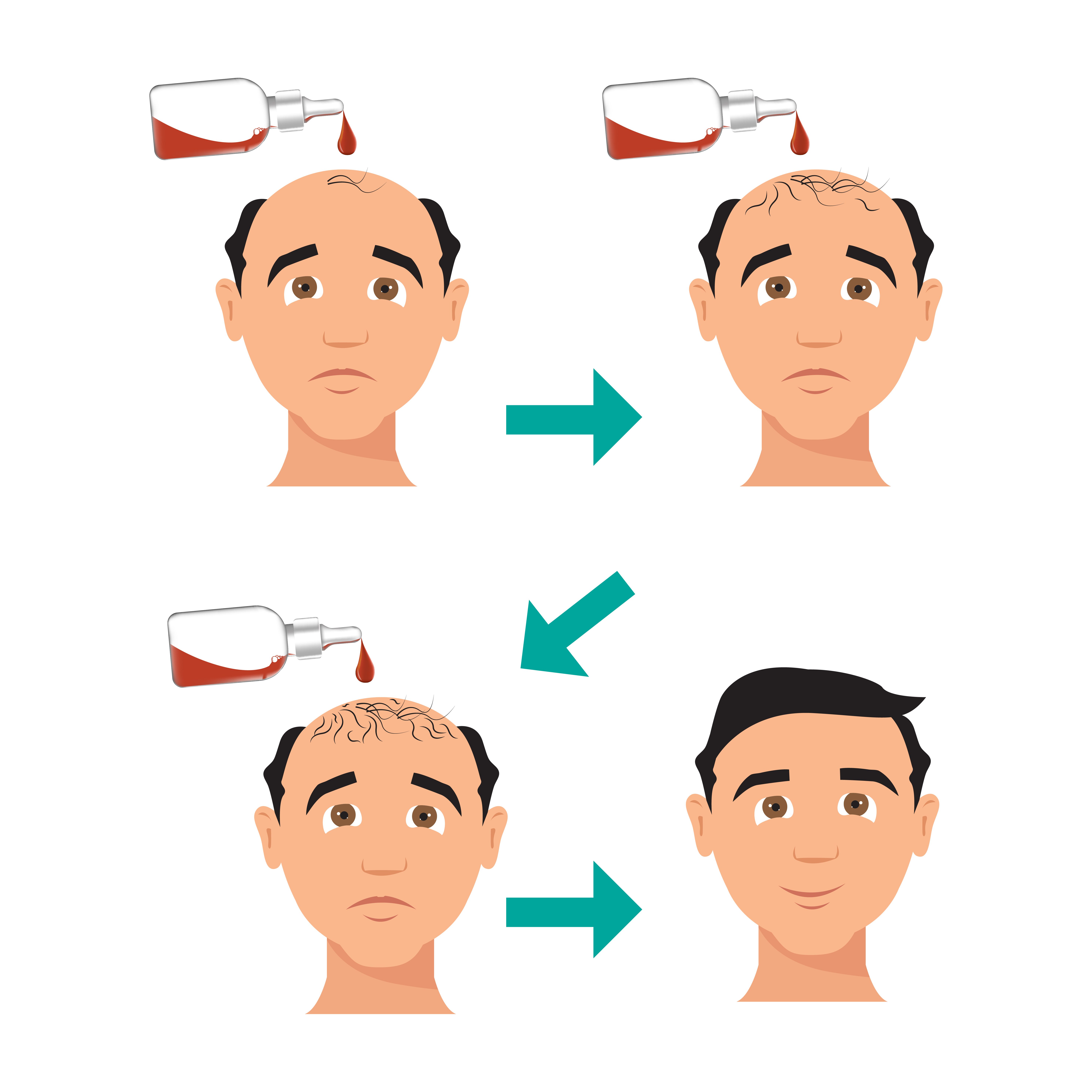 Hair Transplant in Sikar | Best Dermatologist in Sikar