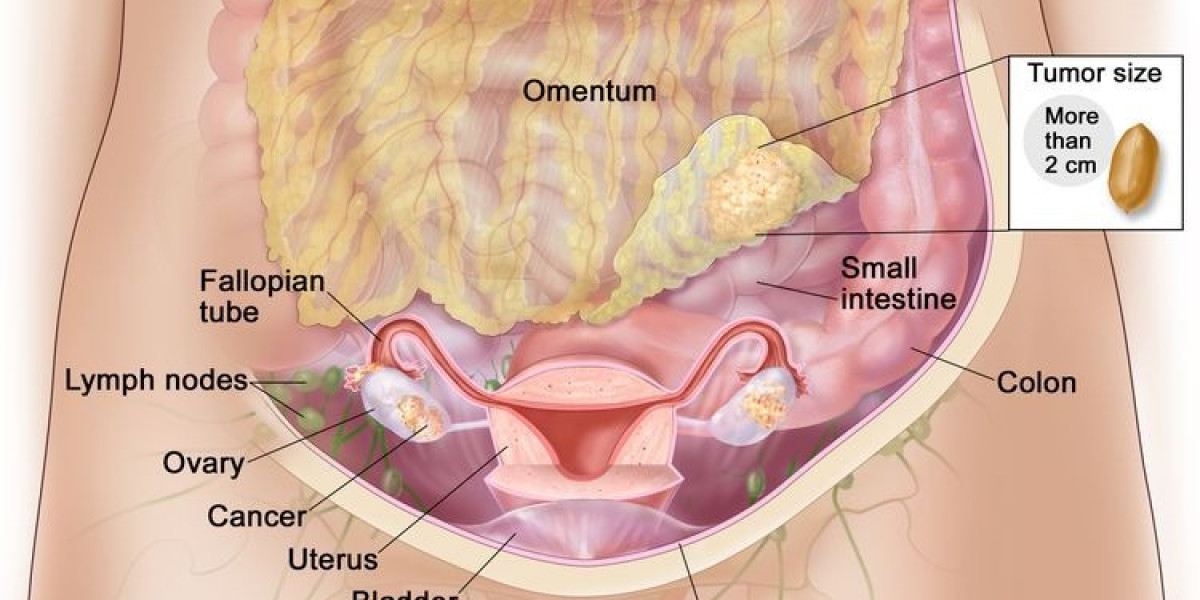 Fallopian Tube Cancer Market Growth Analysis, Size, Share, Report 2024-34